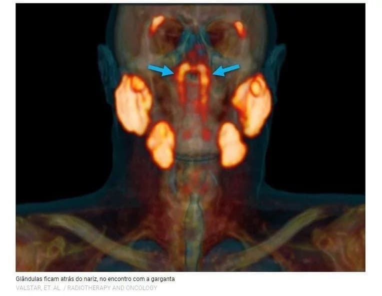 Cientistas holandeses dizem ter encontrado um novo órgão na cabeça humana